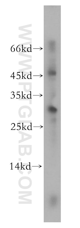 Western Blot (WB) analysis of human kidney tissue using NRIP2 Polyclonal antibody (17704-1-AP)