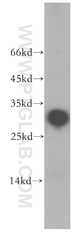 Western Blot (WB) analysis of human heart tissue using NRIP2 Polyclonal antibody (17704-1-AP)