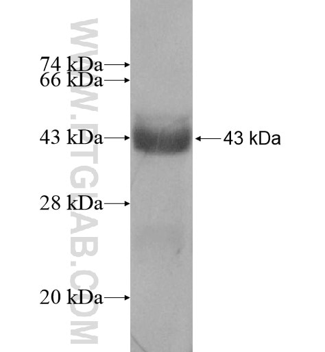NRIP2 fusion protein Ag11983 SDS-PAGE