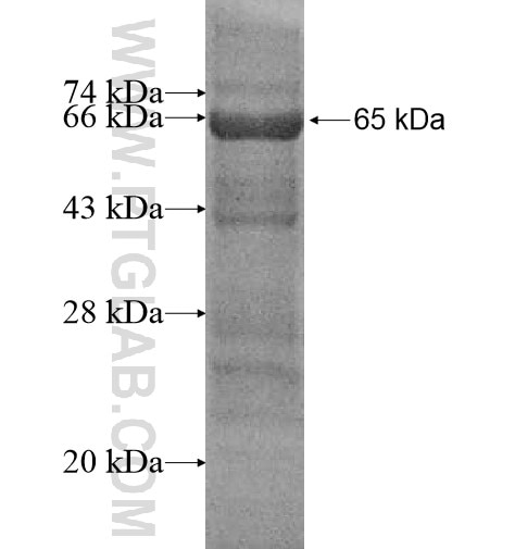 NRIP2 fusion protein Ag11989 SDS-PAGE