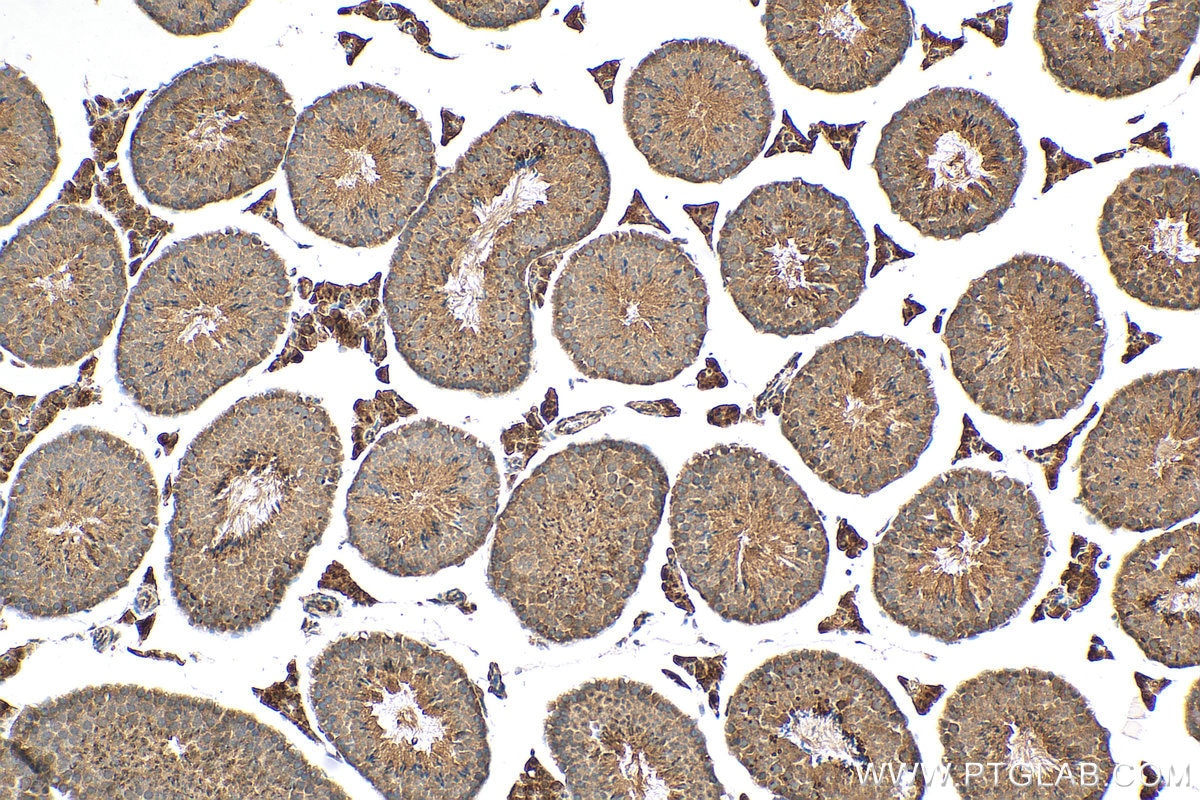 Immunohistochemistry (IHC) staining of mouse testis tissue using NRIP3 Polyclonal antibody (15664-1-AP)