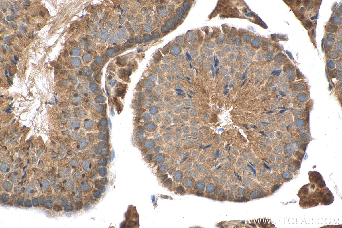 Immunohistochemistry (IHC) staining of mouse testis tissue using NRIP3 Polyclonal antibody (15664-1-AP)