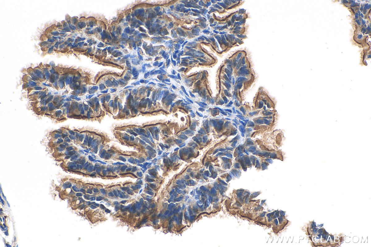 Immunohistochemistry (IHC) staining of mouse ovary tissue using NRIP3 Polyclonal antibody (15664-1-AP)