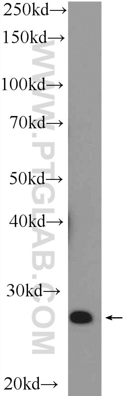 WB analysis of MCF-7 using 15664-1-AP