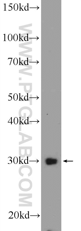 WB analysis of HeLa using 15664-1-AP