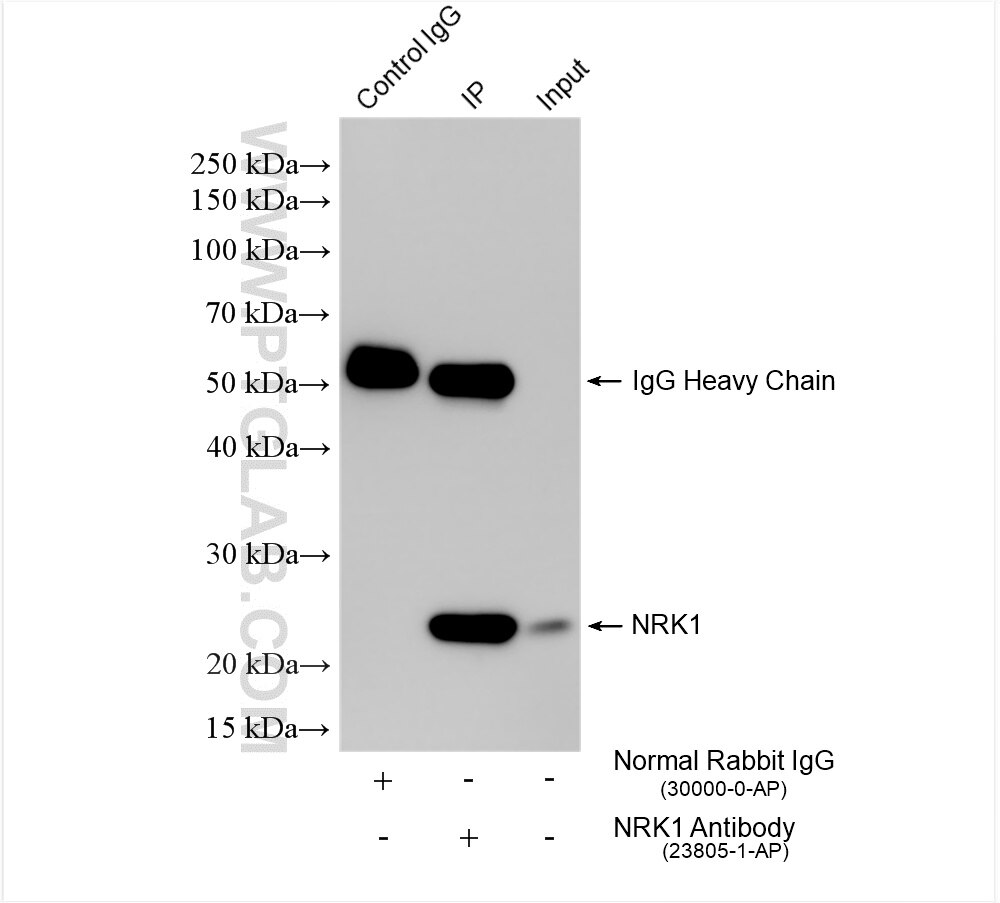 IP experiment of mouse kidney using 23805-1-AP (same clone as 23805-1-PBS) Immunoprecipitation (IP) experiment of mouse kidney tissue using NRK1 Polyclonal antibody (23805-1-AP)