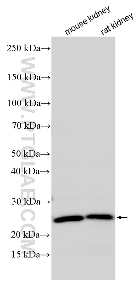 WB analysis using 23805-1-AP Western Blot (WB) analysis of various lysates using NRK1 Polyclonal antibody (23805-1-AP)