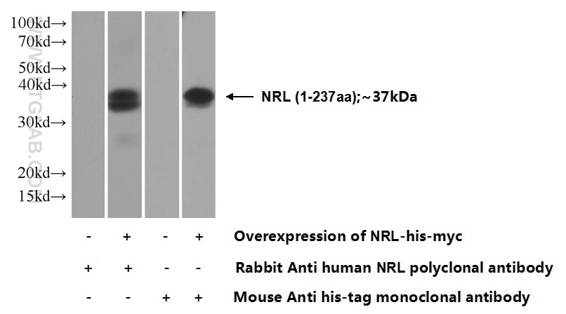 WB analysis of Transfected HEK-293 using 17388-1-AP