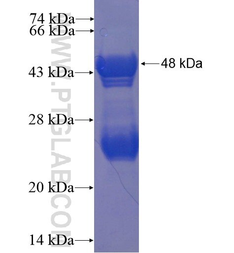 NRL fusion protein Ag11277 SDS-PAGE