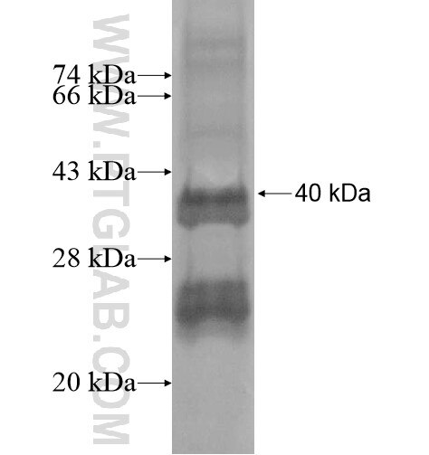 NRN1L fusion protein Ag15755 SDS-PAGE