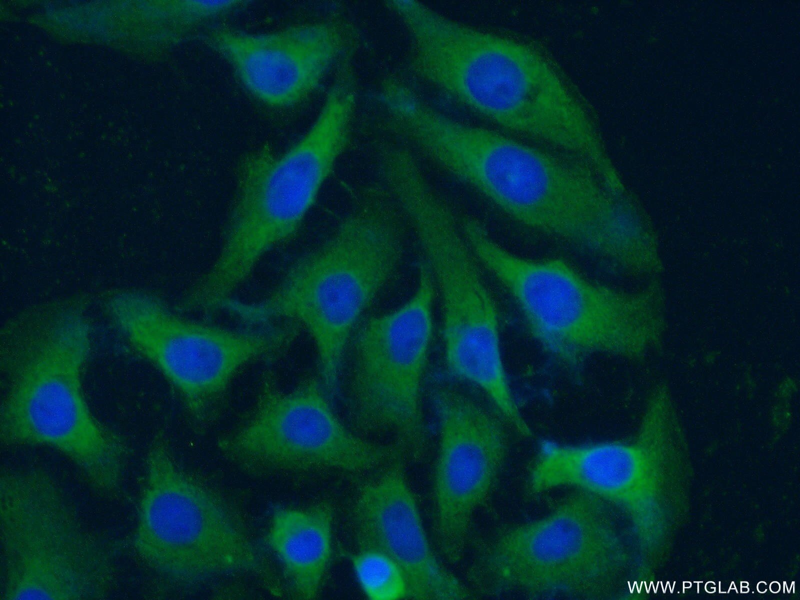 IF Staining of SH-SY5Y using 60067-1-Ig