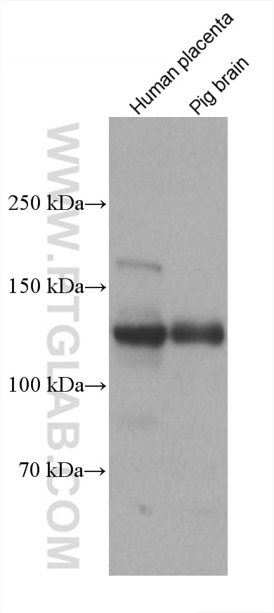 Western Blot (WB) analysis of various lysates using Neuropilin 1 Monoclonal antibody (60067-1-Ig)