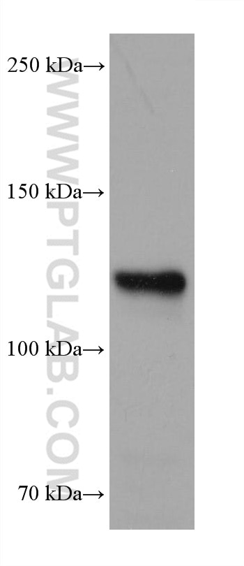 Western Blot (WB) analysis of HeLa cells using Neuropilin 1 Monoclonal antibody (60067-1-Ig)
