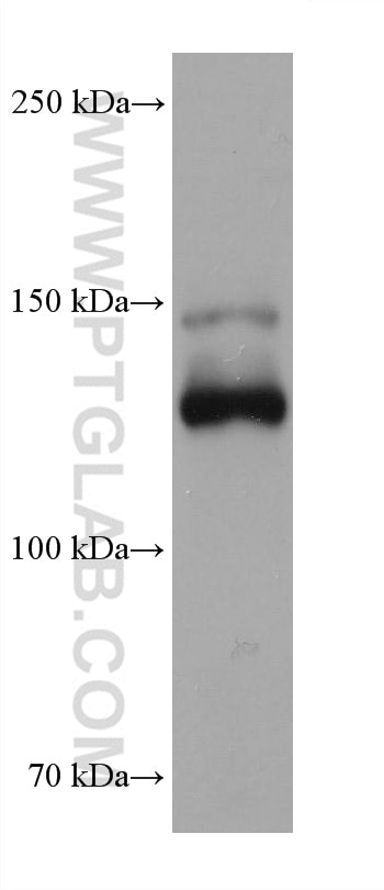 Western Blot (WB) analysis of rabbit heart tissue using Neuropilin 1 Monoclonal antibody (60067-1-Ig)