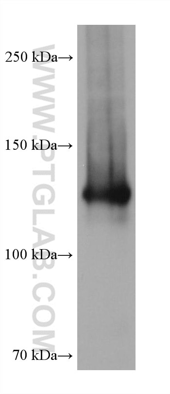 Western Blot (WB) analysis of MDA-MB-231 cells using Neuropilin 1 Monoclonal antibody (60067-1-Ig)