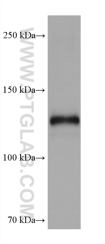 Western Blot (WB) analysis of A549 cells using Neuropilin 1 Monoclonal antibody (60067-1-Ig)