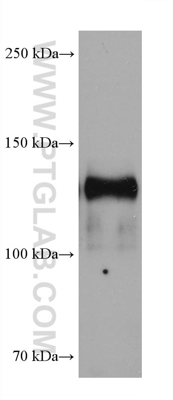 Western Blot (WB) analysis of pig heart tissue using Neuropilin 1 Monoclonal antibody (60067-1-Ig)