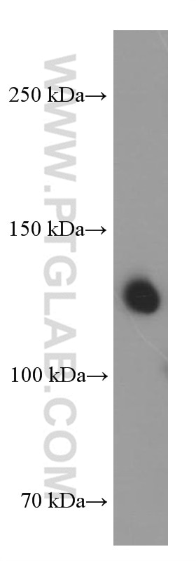 Western Blot (WB) analysis of fetal human brain tissue using Neuropilin 1 Monoclonal antibody (60067-1-Ig)