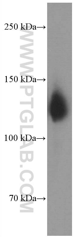 Neuropilin 1 Monoclonal antibody