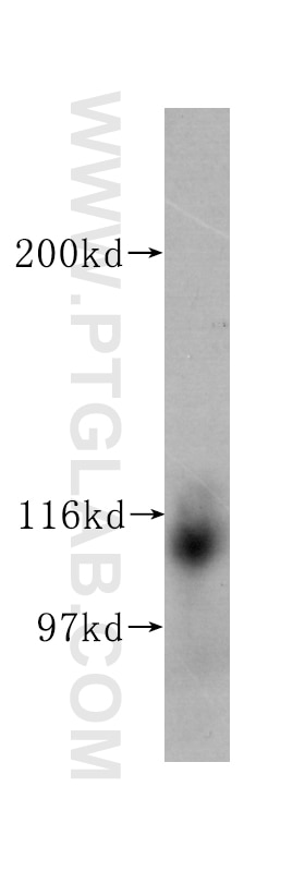 Western Blot (WB) analysis of human plasma using Neuropilin 1 Monoclonal antibody (60067-1-Ig)