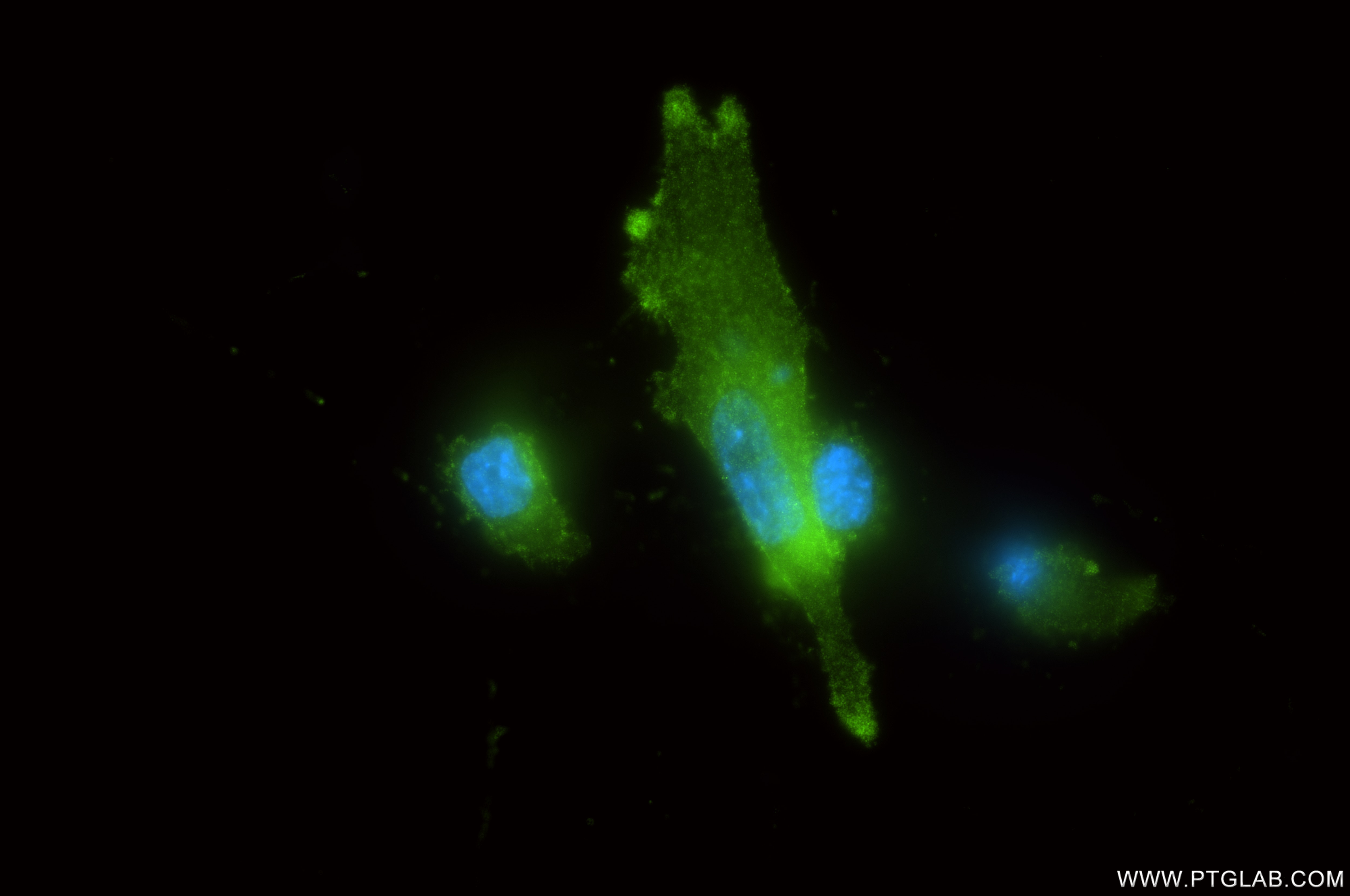 Immunofluorescence (IF) / fluorescent staining of U-87 MG cells using Neuropilin 2 Recombinant antibody (86126-3-RR)