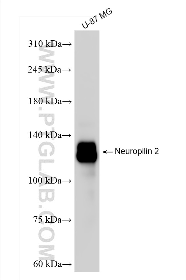 Neuropilin 2