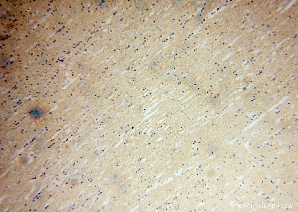 Immunohistochemistry (IHC) staining of human brain tissue using NRSN2 Polyclonal antibody (17574-1-AP)