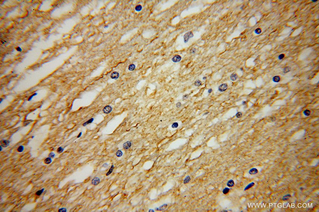 Immunohistochemistry (IHC) staining of human brain tissue using NRSN2 Polyclonal antibody (17574-1-AP)