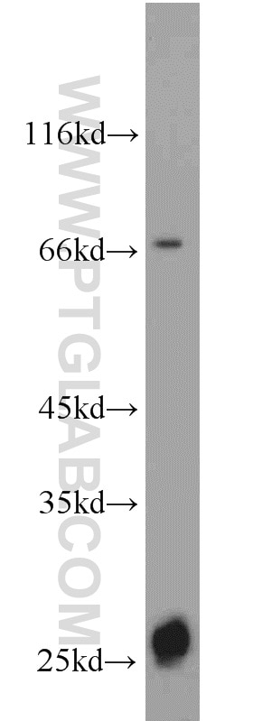 Western Blot (WB) analysis of human brain tissue using NRSN2 Polyclonal antibody (17574-1-AP)