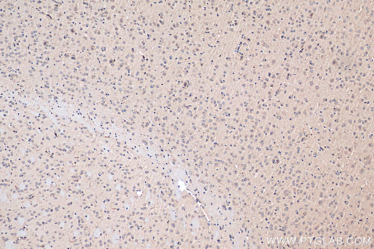 Immunohistochemistry (IHC) staining of mouse brain tissue using neurturin-Specific Polyclonal antibody (19709-1-AP)