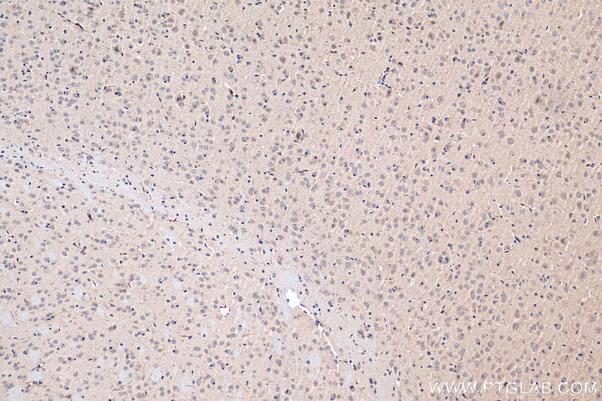 IHC staining of mouse brain using 19709-1-AP