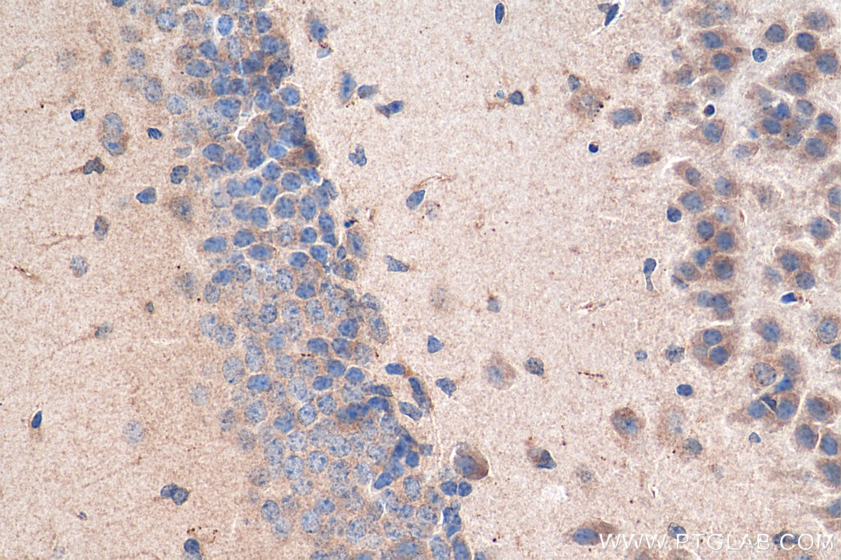 Immunohistochemistry (IHC) staining of mouse brain tissue using neurturin-Specific Polyclonal antibody (19709-1-AP)