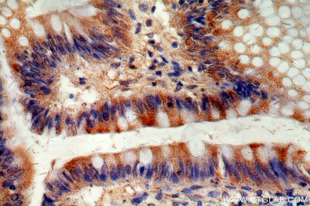 Neurturin