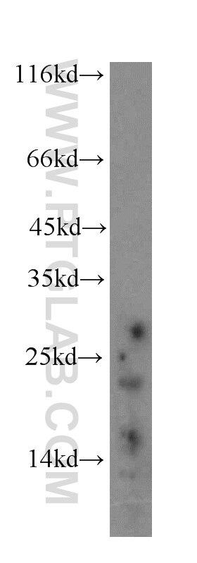 Western Blot (WB) analysis of human liver tissue using neurturin-Specific Polyclonal antibody (19709-1-AP)