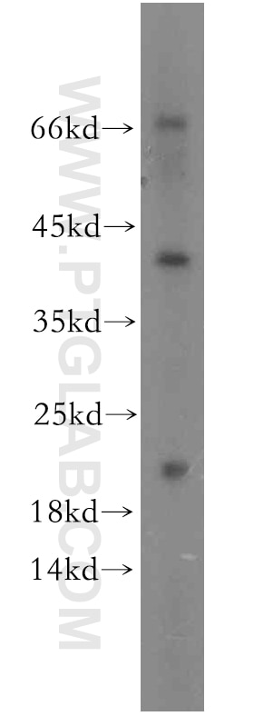 Western Blot (WB) analysis of human heart tissue using neurturin-Specific Polyclonal antibody (19709-1-AP)