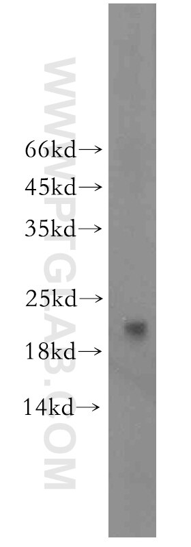 Western Blot (WB) analysis of human liver tissue using neurturin-Specific Polyclonal antibody (19709-1-AP)