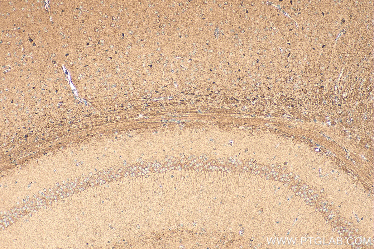 Immunohistochemistry (IHC) staining of mouse brain tissue using NRXN1 Polyclonal antibody (55051-1-AP)