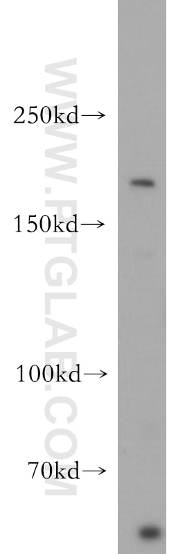 Western Blot (WB) analysis of SH-SY5Y cells using NRXN1 Polyclonal antibody (55051-1-AP)