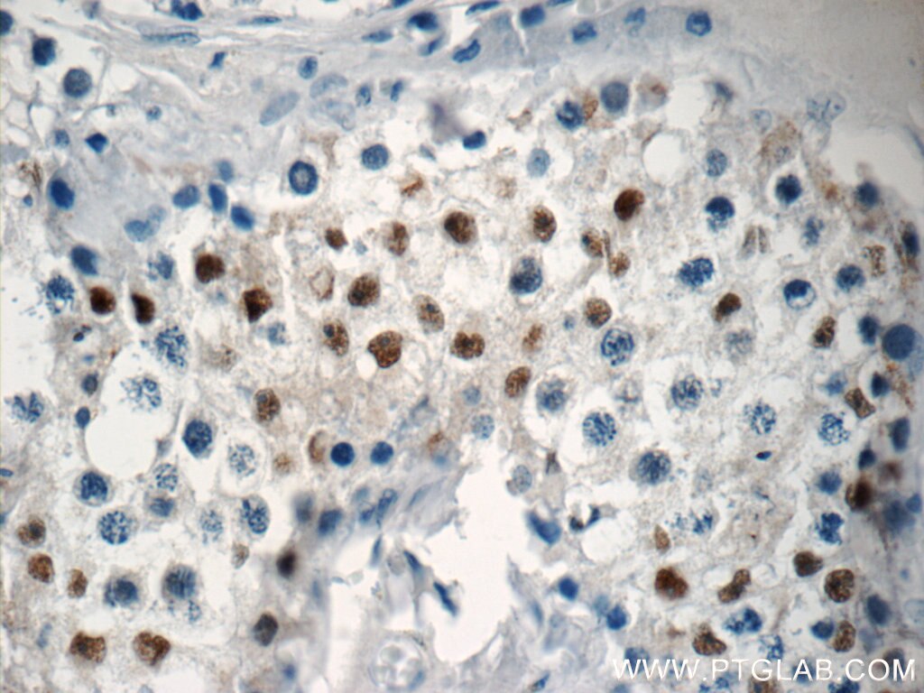 Immunohistochemistry (IHC) staining of human testis tissue using NSBP1 Polyclonal antibody (23955-1-AP)