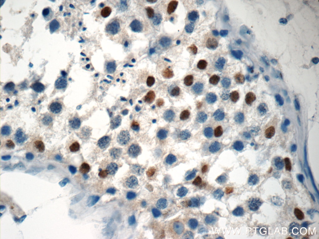 IHC staining of human testis using 23955-1-AP