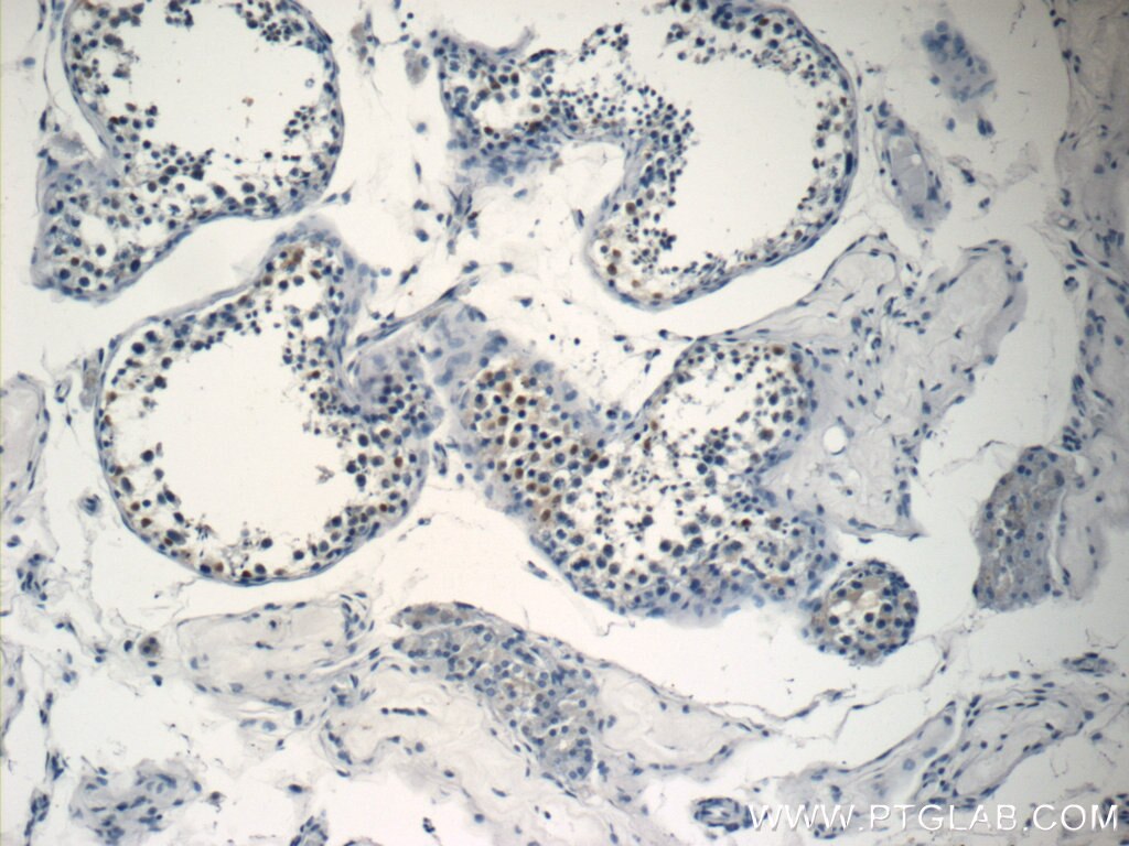 Immunohistochemistry (IHC) staining of human testis tissue using NSBP1 Polyclonal antibody (23955-1-AP)