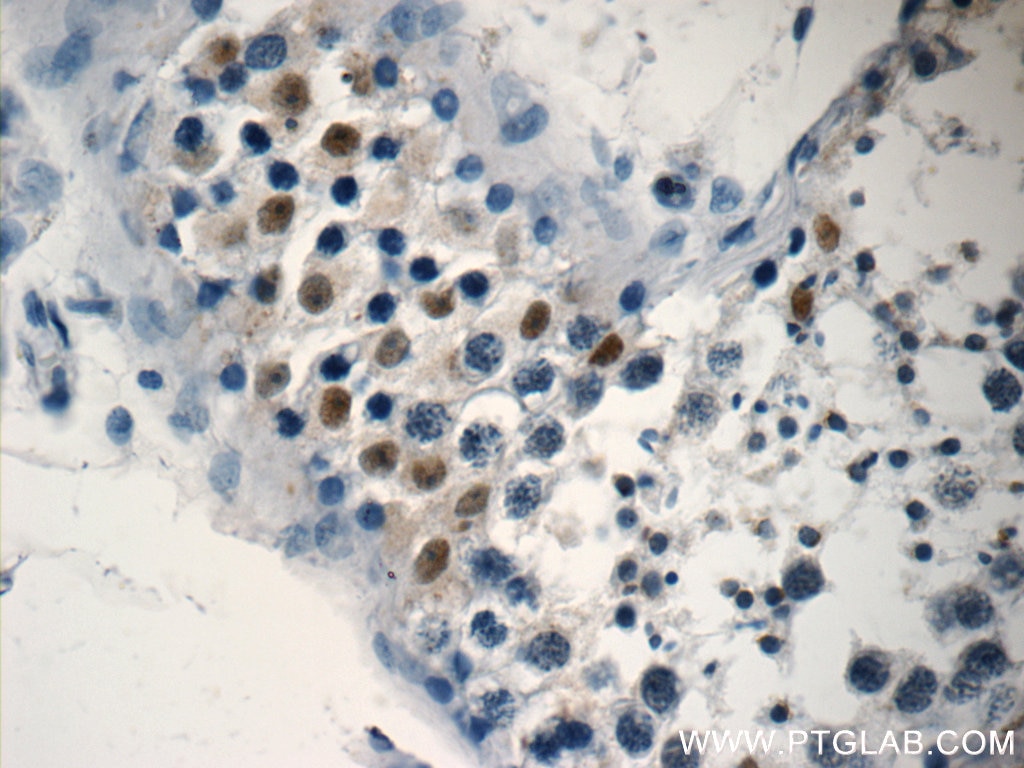 Immunohistochemistry (IHC) staining of human testis tissue using NSBP1 Polyclonal antibody (23955-1-AP)