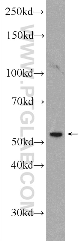 Western Blot (WB) analysis of PC-3 cells using NSBP1 Polyclonal antibody (23955-1-AP)