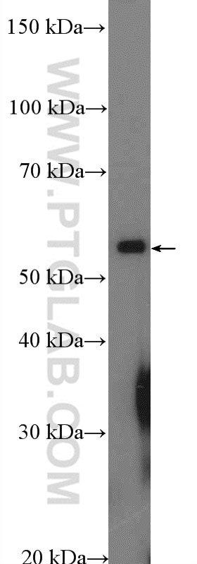 Western Blot (WB) analysis of HeLa cells using NSBP1 Polyclonal antibody (23955-1-AP)