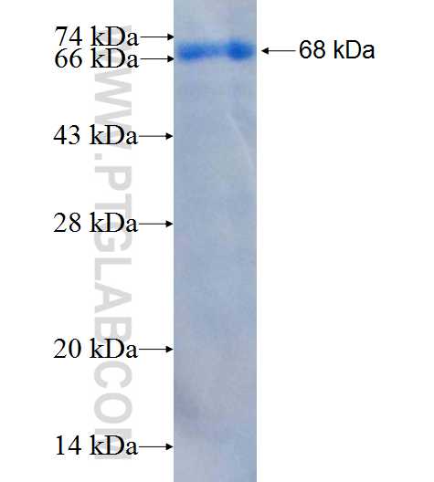 NSD1 fusion protein Ag26425 SDS-PAGE