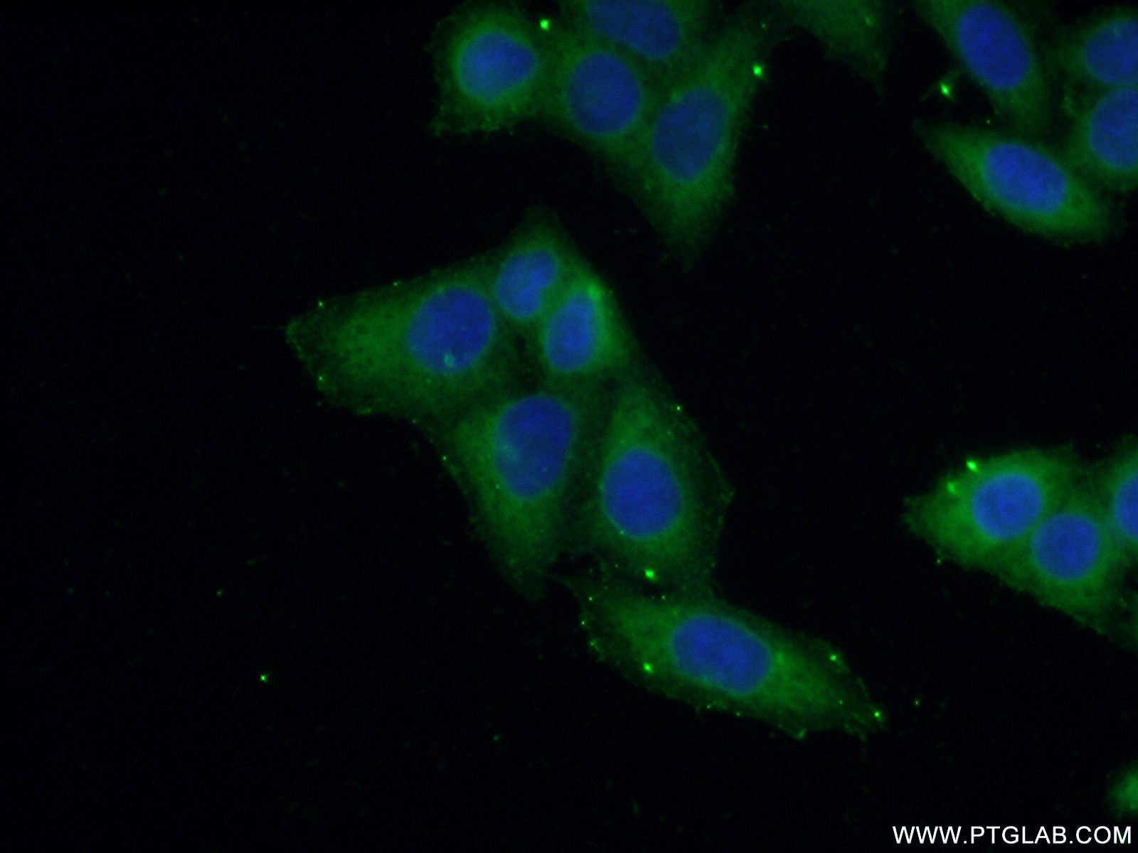 IF Staining of HeLa using 15111-1-AP