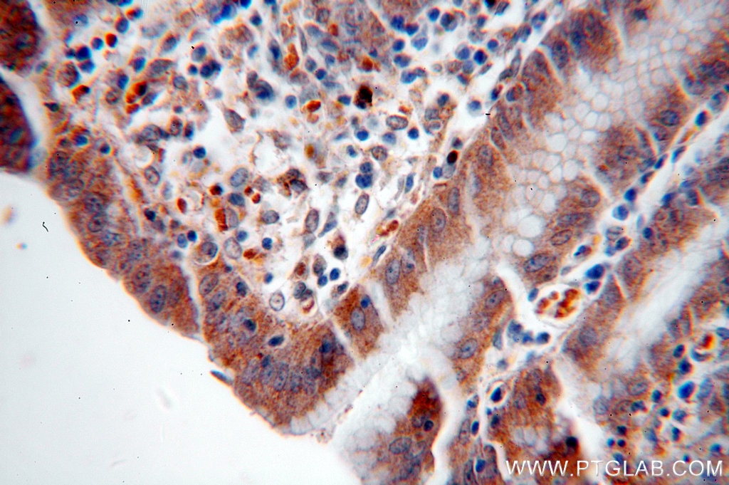 Immunohistochemistry (IHC) staining of human stomach tissue using NSDHL Polyclonal antibody (15111-1-AP)