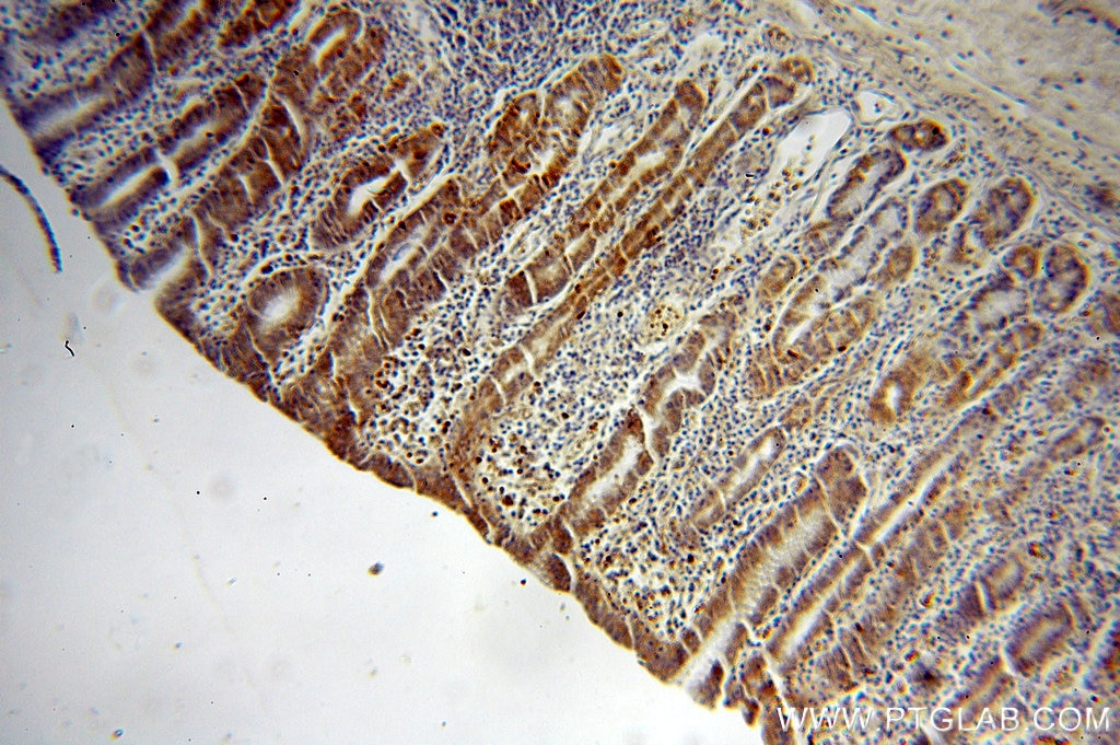 Immunohistochemistry (IHC) staining of human stomach tissue using NSDHL Polyclonal antibody (15111-1-AP)