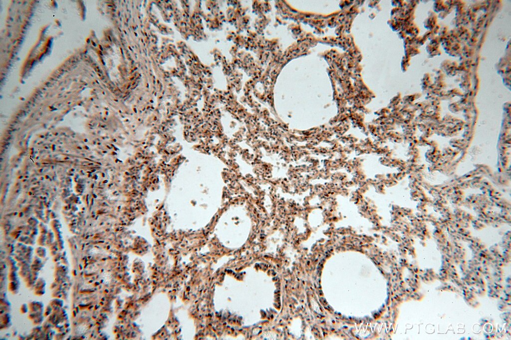 IHC staining of human lung using 15111-1-AP