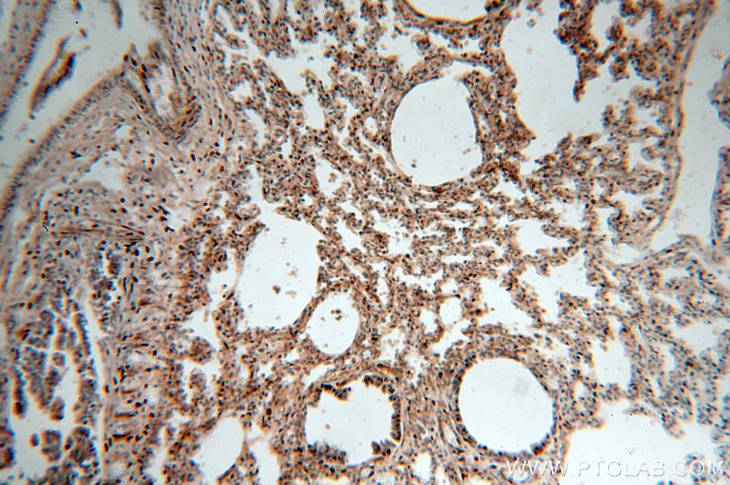 Immunohistochemistry (IHC) staining of human lung tissue using NSDHL Polyclonal antibody (15111-1-AP)